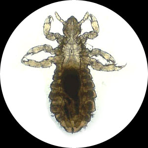 Head lice are blood sucking ectoparasites of human - Head lice are blood sucking ectoparasites of humans, from the family of lice Pediculidae