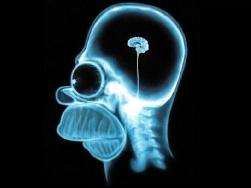 Homer Simpson. - This is an xray of Homer Simpsons brain.