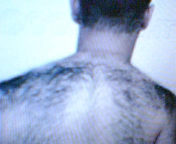 hairy back - people with hairy back