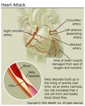 heart attack - It's hard to have a heart attackyou know. So please take care of yourself always.
