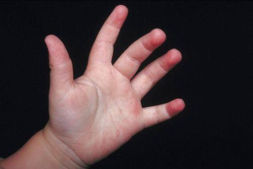 The hand of a baby that was not aborted. - If you had been aborted, this would have never been your hand, because babies that are alive weren&#039;t aborted. Some aborted babies live, but their hands don&#039;t usually look as good as this one.