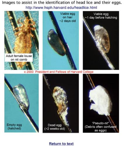 lice and nits  - nasty buggers and what they look like