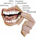 Wisdom teeth - Pull out?