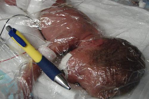 so tiny - preemies,newborn