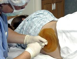Epidural being administered - This is a random picture that I found of an epidural being administered.