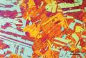 metallography - A true microstructure