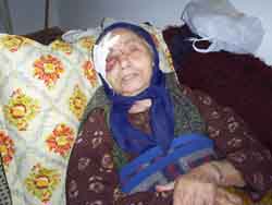 A grandmother attacked - A picture of a grandmother attacked in her own house