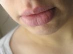 dry lips - Dry lips is a definite no, no for me. Whenever I have dry lips, I use petroleum jelly or lip balm.