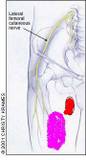 diagram of a human leg - This picture is used to illustrate the leg and muscle pain caused from restless leg symdrome.