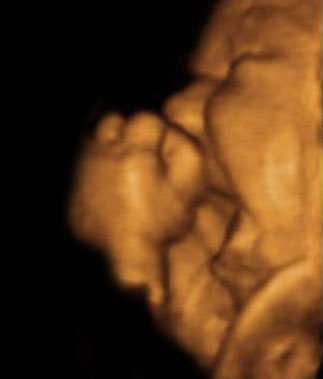 3D Baby Uttra Sound - I was just wondering how many of you's had a baby 3D baby ultra sound done and what you think about the whole experience? Please share