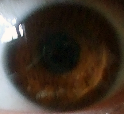 eyes see - what I see, my eye