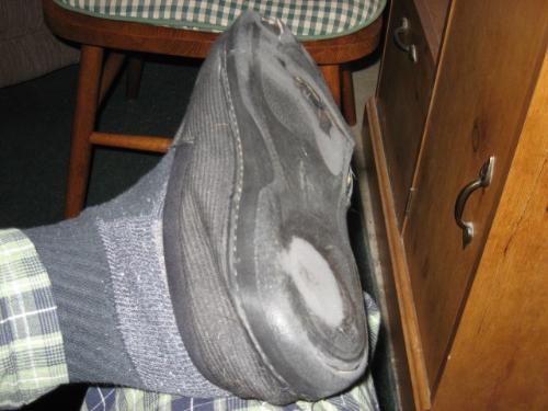 Really Worn Out - Just another sign of a walking and healthy foot.