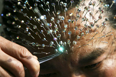 Self Acupunture - Wei Shengchu inserts needles into his forehead during a self-acupuncture performance in Chongqing, China, Jan. 9. He inserted 1,200 needles in all, less than the 1,790 that earned him the world record.