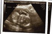 ultrasound of my baby - ultrasound