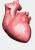 heart attack - kb2115 a boon for heart patients