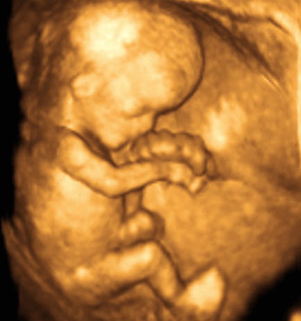 3d echography - a picture of a baby took in 3d echography