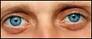 puffy eyes - puffy eyes -swelling in eye lids
