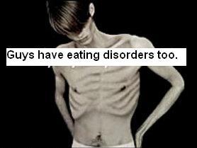 Anorexia- ED - Eating Disorder