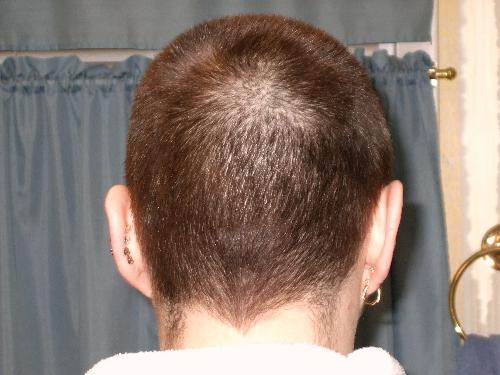 My hair, as of Feb. 2 - I had my Honey snap this photo right after I posted the Bald by Choice discussion. This is what 33 days of growth looks like for my hair.