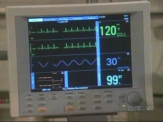 heart monitor - heart monitor racing as Alexis asks Kate who 'Olivia' is