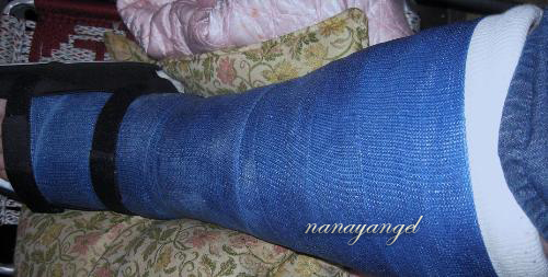 Cast - Signing your cast