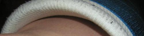 itchy  - I shove a paint stirring stick between my cast and my leg to relieve itches.  have you ever lost anything down your cast?