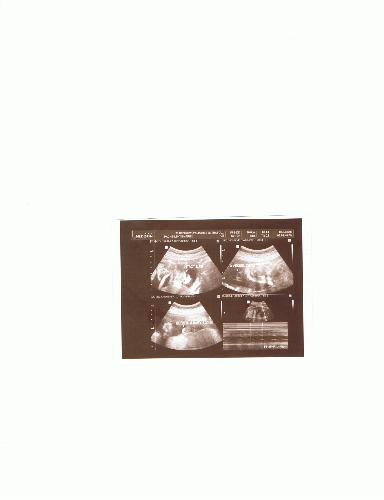 My baby in his 7th month - This is an ultrasound of my baby on his 7th month in my womb. I can't wait to see him! My baby in his 7th month - This is an ultrasound of my baby on his 7th month in my womb. I can't wait to see him!