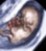 fetus - small fetus