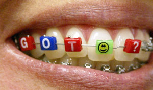 braces - Picture of a female with braces!!!