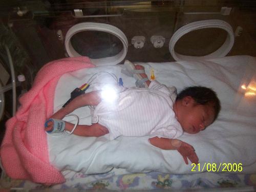 Premature baby - This is a photo of my baby born at 32 weeks