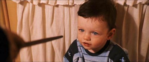 Harry Potter getting the scar - Harry Potter has the wand of Voldemort on his head, but because his mother sacrificed herself for him, he lived and voldemort lost human form.