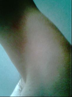 arm pic - This the arm,it does looks nude,right? arm pic - This the arm,it does looks nude,right?