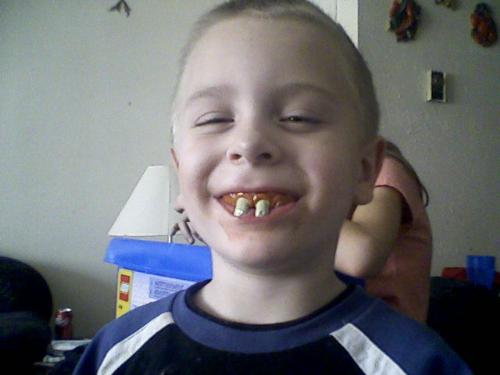 Being silly - This is my oldest with funny teeth. No they arent his.