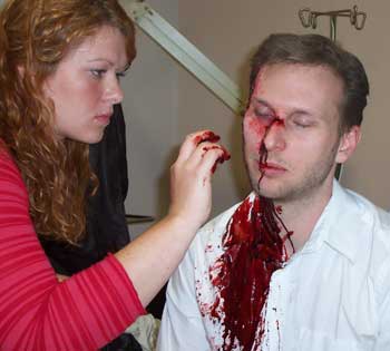 A man bleeding - I don't know who is he it was save in my computer