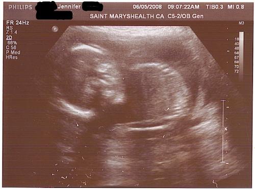 My Ultra Sound - My lil baby My Ultra Sound - My lil baby