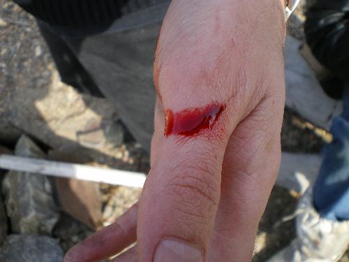 Ouch - My clumsy boyfriend's clash with a sharp piece of slate. LOL