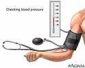 low blood pressure - Blood pressure