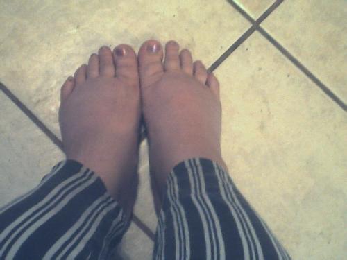 My pillsbury doughboy feet - even my feet are pregnant!!