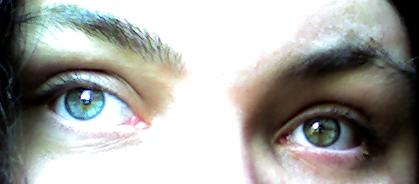 My eyes. - One eye is blue, the other, well, I am not quite sure.