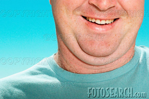 obesity - Double chinned man.