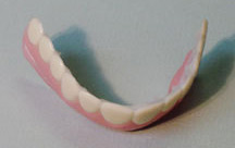 cosmetic teeth - This is one pic of how the teeth look.