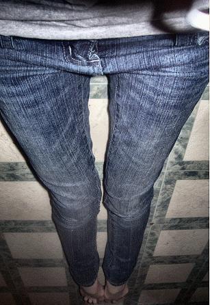 weight loss - skinny legs