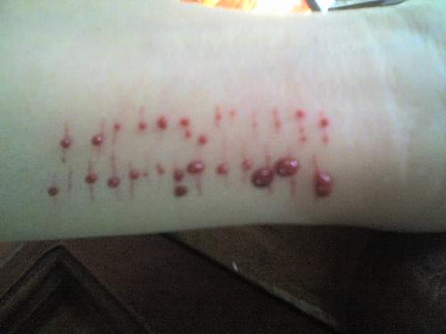 mY pAiN - cAn i sUrViVe 2 d PaiN tHeY uSeD t0 gAvE mE?!