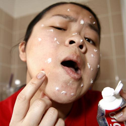 Drawing Attention To Yourself - Just a girl examing her zit and putting toothpaste on it to make it disappear lol... Drawing Attention To Yourself - Just a girl examing her zit and putting toothpaste on it to make it disappear lol...
