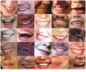 White Teeth Smiles - Whites Teeth smiles
