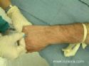 inserting an IV catheter - this is what we have demoed yesterday