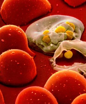hiv - HIV Virus attacking good cells