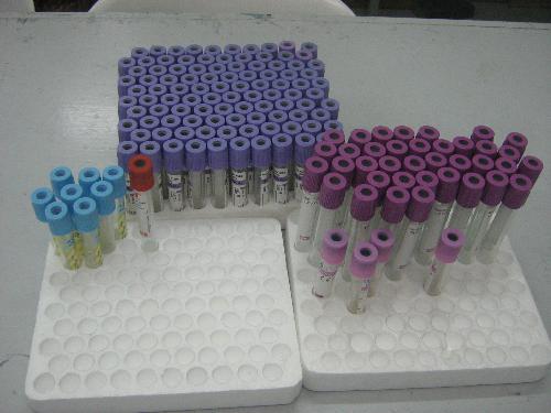 Vacutainer Tubes - Vacutainer tubes are materials used when performing venipuncture. Venipuncture is the extraction of blood from the veins of a patient.