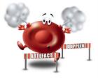 What Is High Blood Pressure? - Many are very regular to this one rite or many of them know what it is do you have this disease ya it is disease rite it is caused due to the blood force in the arteries i think and many of them say that due to tensions it will is it true and some say that due to fat content is it comes to the people below age of 35 also.