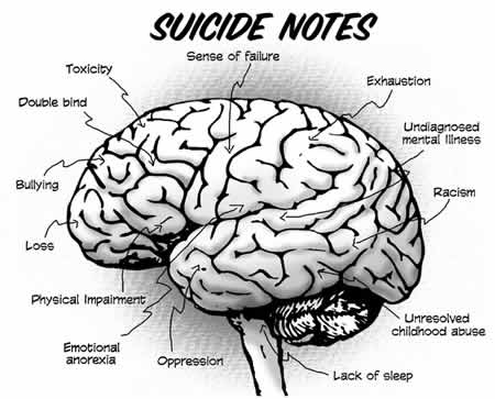 Suicide Brain  - Brain of a suicidal person